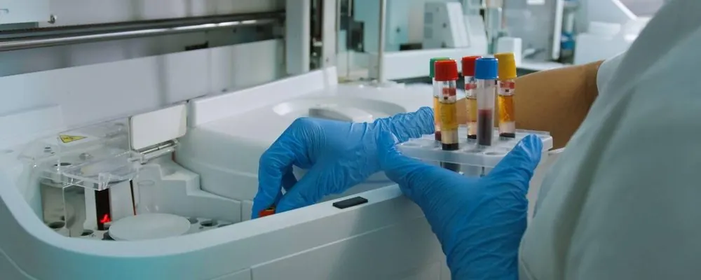 Gants bleus et tubes d’échantillons dans un automate d’analyse : nettoyage d’un laboratoire d’analyses médicales